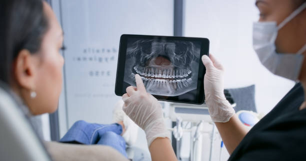 Licensed Tooth Extraction service in New Albany, OH - Smile Center Dentistry